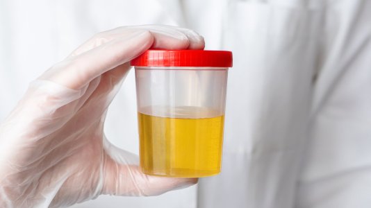 what-are-urine-specimen-collection-procedures-for-a-dot-drug-test.jpg